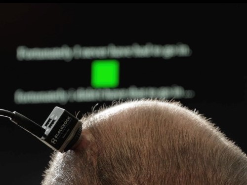 An investigational device is on top of a man's head with a computer screen in the background