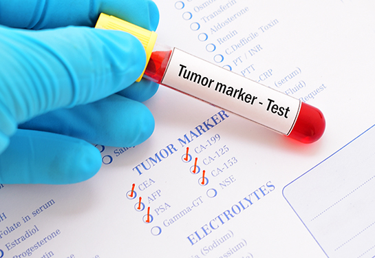 Blood sample with requisition form for tumor marker test