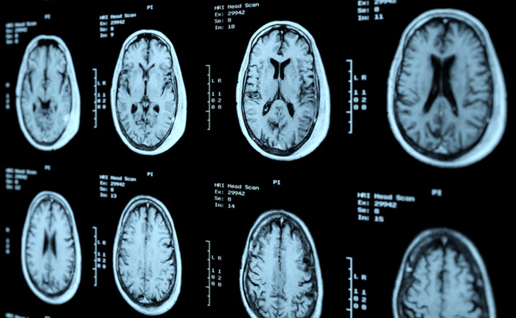 An MRI head scan perspective