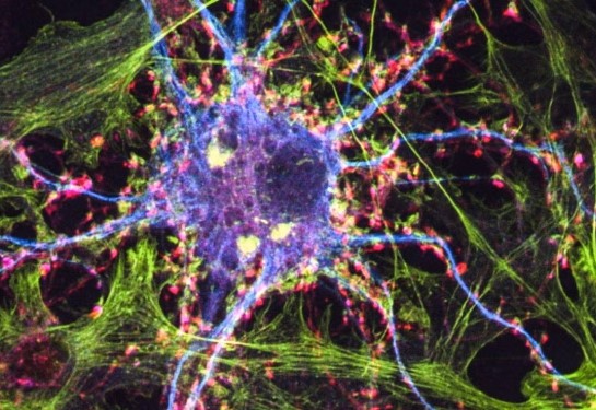 Colored image of nerve cells. 