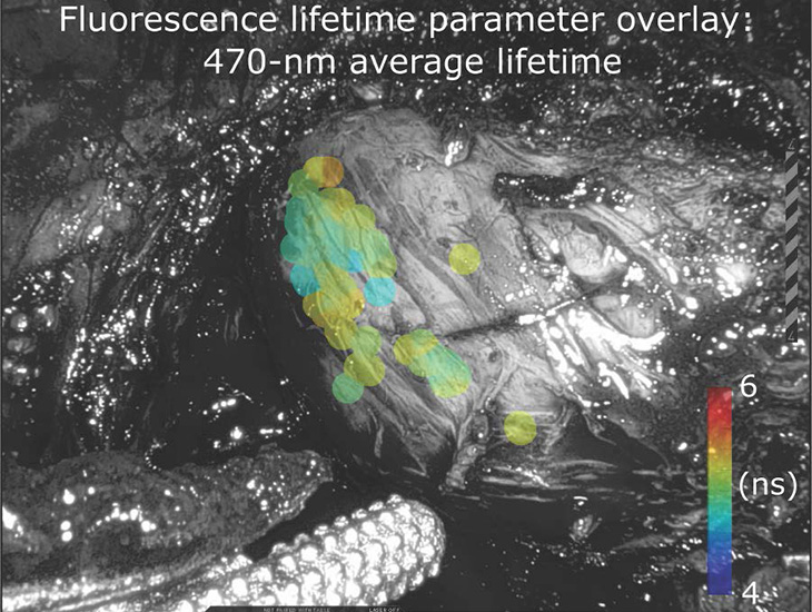 Fluorescence lifetime parameter overlay 470nm average lifetime