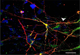 chromosome activation