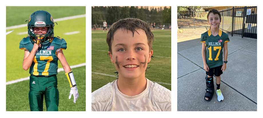Three photos of a young boy: Up close shot with eye black on his face; in full football uniform which is green and gold; wearing football jersey and an orthopaedic boot on one foot and a white tennis shoe on the other.