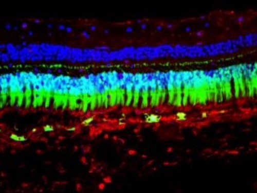 Fluorescent images of individual cells in the retina.