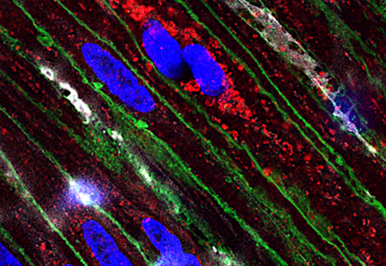 Piezo1 in smooth muscle cell